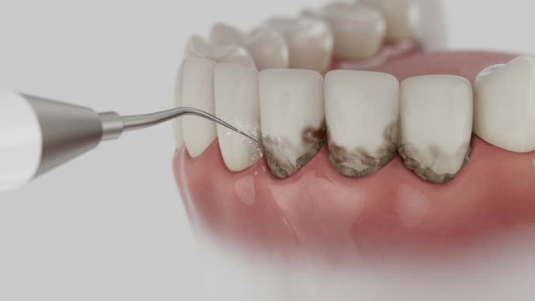 Reliable Dental contractor in Lincoln Village, OH by Dentist Open Now